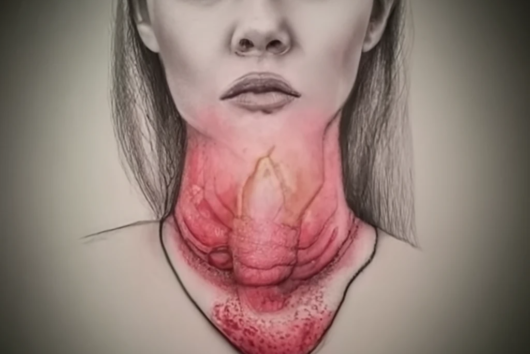 Ви керуєте своїм тілом чи тіло керує Вами?